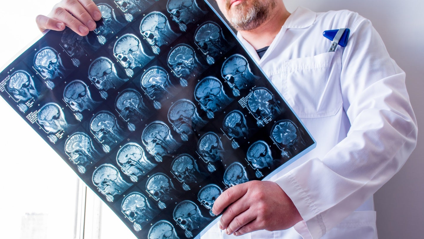 BRAINBox and Prolight sign supply agreement for concussion tests