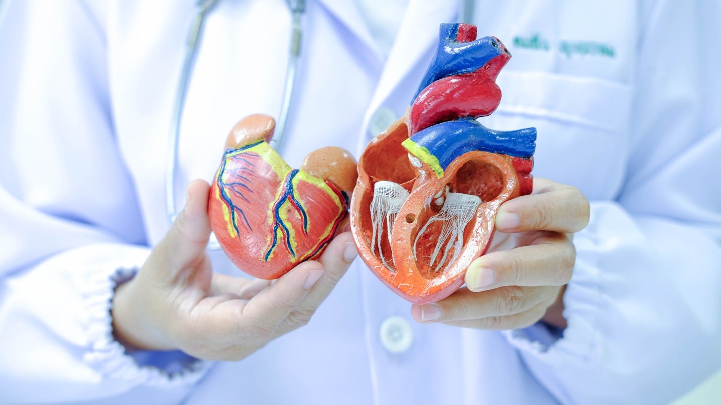 FDA approves Cordis SELUTION SLR for coronary in-stent restenosis
