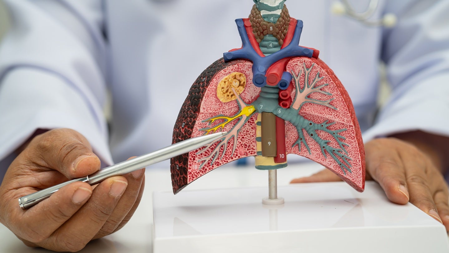 FDA clears Cepheid’s multiplex respiratory panel test