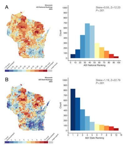 Brains age faster among residents in disadvantaged neighborhoods