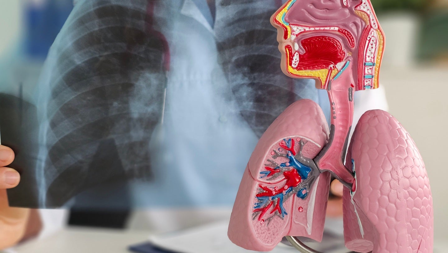 First patient dosed in Vial’s Phase Ib trial of IL-13 x TSLP antibody