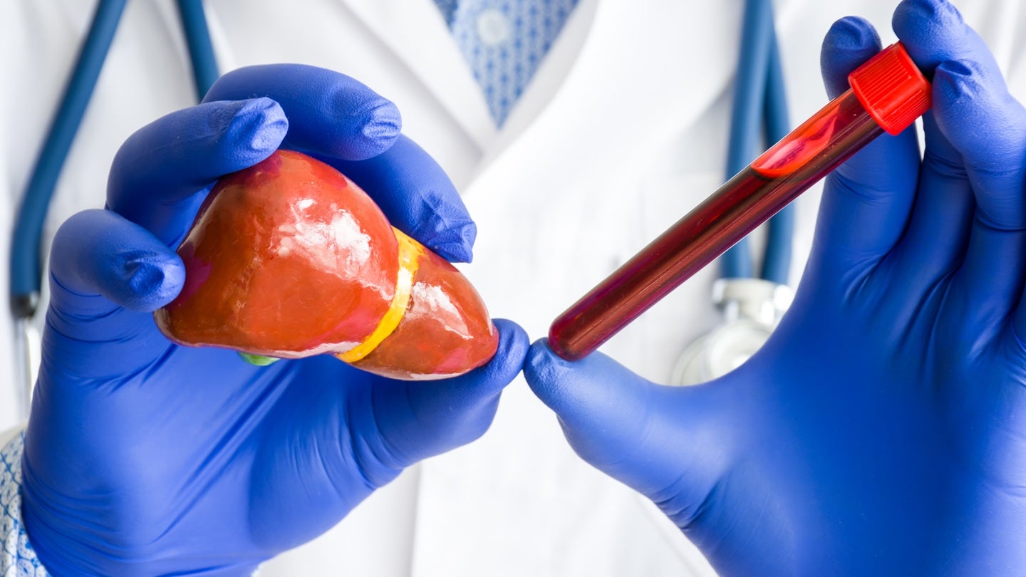 Pilatus doses first patient in Phase I PLT012 trial for HCC