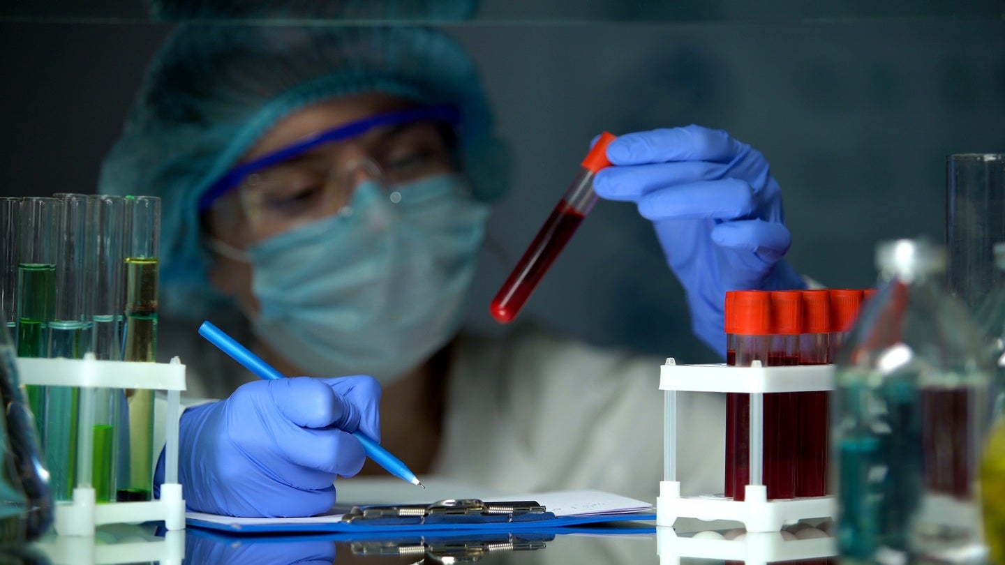 USC initiates trial of blood test for breast cancer