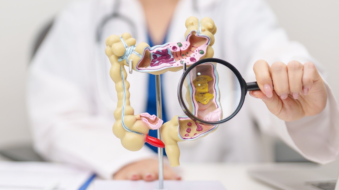 Abbott secures CE Mark for Cologuard Plus cancer test