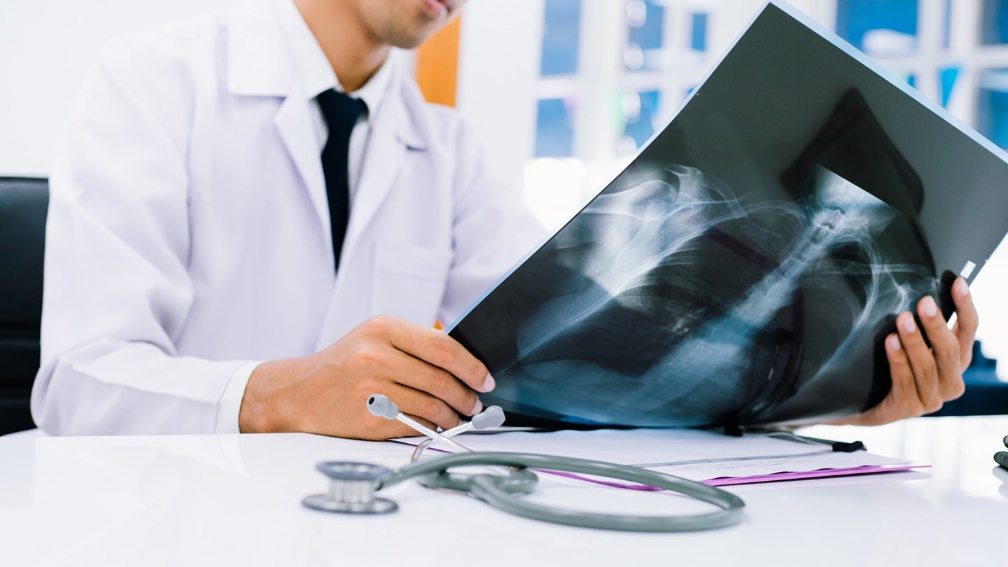 FDA clears Coreline Soft’s AVIEW Aorta Metrics software