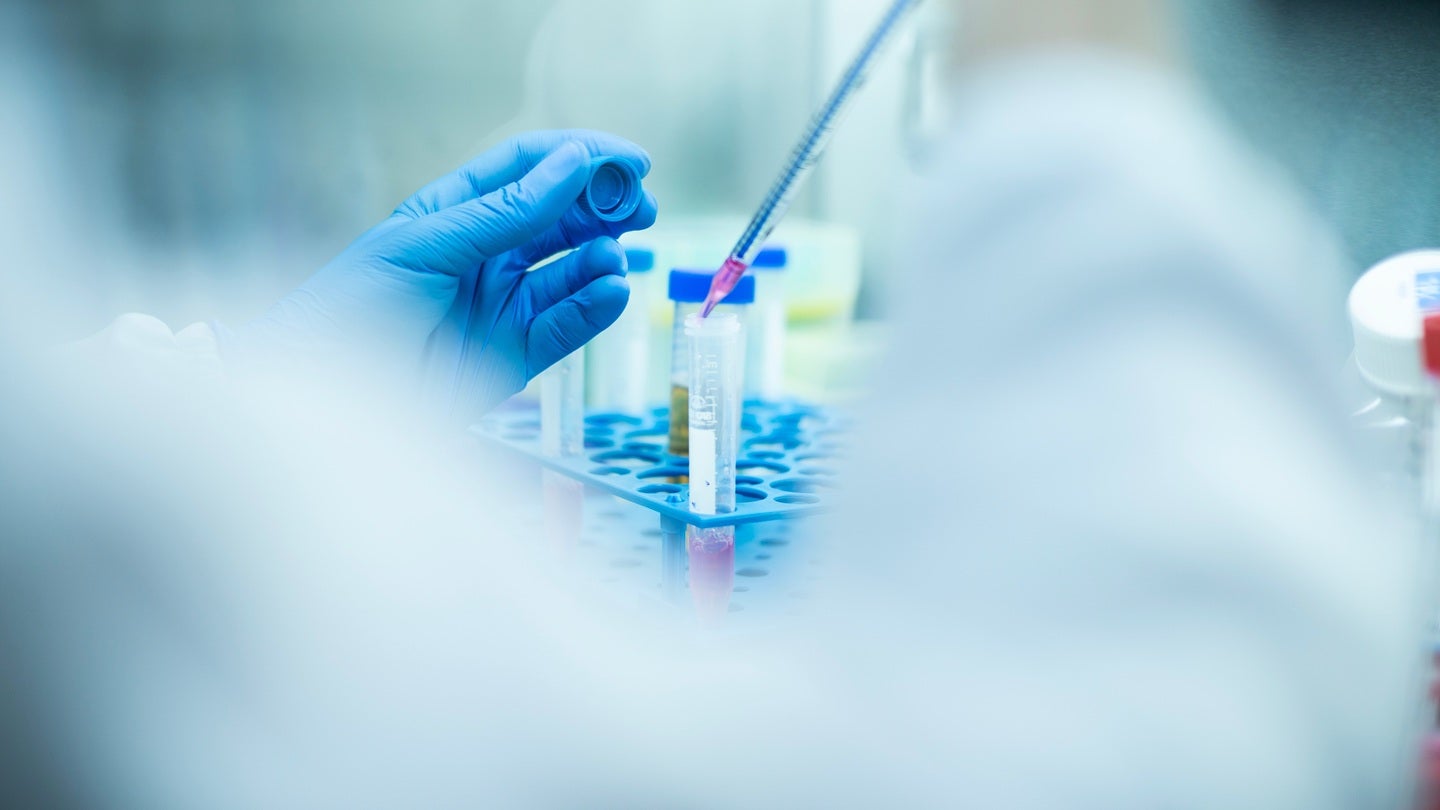Dren Bio raises $350m for dibotatug clinical development