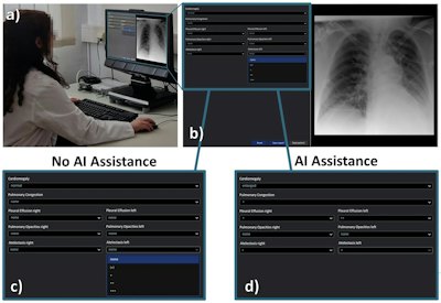 AI fails to compensate for night-shift fatigue among residents
