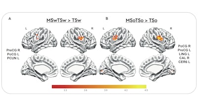 fMRI reveals how music enhances food taste