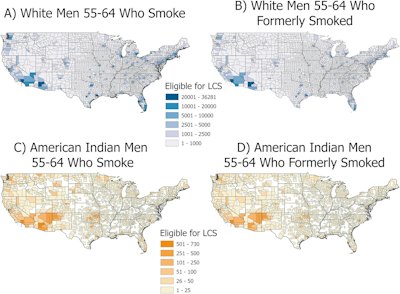 New dataset maps people eligible for LDCT lung cancer screening